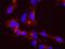 ATR Serine/Threonine Kinase antibody, NB100-323, Novus Biologicals, Proximity Ligation Assay image 