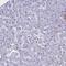 Parathyroid Hormone Like Hormone antibody, PA5-57493, Invitrogen Antibodies, Immunohistochemistry paraffin image 