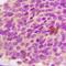 Galactosylceramidase antibody, LS-C667807, Lifespan Biosciences, Immunohistochemistry paraffin image 