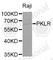 Pyruvate Kinase L/R antibody, A1924, ABclonal Technology, Western Blot image 