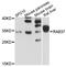 RAB37, Member RAS Oncogene Family antibody, LS-C748739, Lifespan Biosciences, Western Blot image 