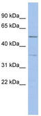 Abhydrolase Domain Containing 15 antibody, TA337609, Origene, Western Blot image 