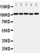 ADAM Metallopeptidase With Thrombospondin Type 1 Motif 5 antibody, PA2072, Boster Biological Technology, Western Blot image 