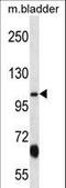 Potassium Voltage-Gated Channel Subfamily Q Member 3 antibody, LS-C165446, Lifespan Biosciences, Western Blot image 