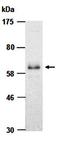 Protein Inhibitor Of Activated STAT 4 antibody, orb66668, Biorbyt, Western Blot image 