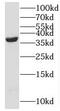 Sialic acid synthase antibody, FNab05543, FineTest, Western Blot image 