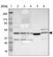 Leucine Rich Alpha-2-Glycoprotein 1 antibody, NBP1-82822, Novus Biologicals, Western Blot image 