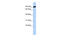 Zinc Finger Protein 132 antibody, 25-277, ProSci, Western Blot image 