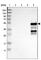 Cytochrome P450 Family 2 Subfamily C Member 19 antibody, HPA015066, Atlas Antibodies, Western Blot image 