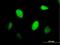 Centromere Protein J antibody, H00055835-B01P, Novus Biologicals, Immunocytochemistry image 