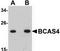 Breast Carcinoma Amplified Sequence 4 antibody, TA306934, Origene, Western Blot image 