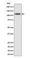 Zinc Fingers And Homeoboxes 2 antibody, M05837-1, Boster Biological Technology, Western Blot image 