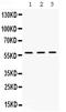 X-Linked Inhibitor Of Apoptosis antibody, PB9965, Boster Biological Technology, Western Blot image 