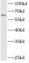Disintegrin and metalloproteinase domain-containing protein 8 antibody, FNab00144, FineTest, Western Blot image 