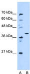 Enoyl-CoA Hydratase Domain Containing 3 antibody, TA346830, Origene, Western Blot image 