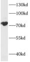 Rho Guanine Nucleotide Exchange Factor 4 antibody, FNab00562, FineTest, Western Blot image 