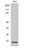 Histone Cluster 1 H2B Family Member H antibody, A12218-1, Boster Biological Technology, Western Blot image 