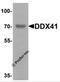 DEAD-Box Helicase 41 antibody, 7349, ProSci, Western Blot image 