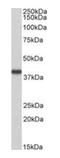 Hydroxyacid Oxidase 2 antibody, orb316839, Biorbyt, Western Blot image 