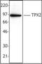 TPX2 Microtubule Nucleation Factor antibody, orb87750, Biorbyt, Western Blot image 