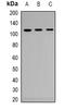 Androgen Receptor antibody, orb339006, Biorbyt, Western Blot image 