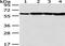 Pyruvate Kinase M1/2 antibody, TA351941, Origene, Western Blot image 