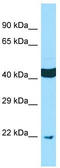 Secretory Carrier Membrane Protein 4 antibody, TA334373, Origene, Western Blot image 