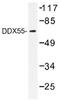 DEAD-Box Helicase 55 antibody, AP01384PU-N, Origene, Western Blot image 
