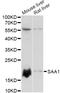 Serum amyloid A-1 protein antibody, A01362, Boster Biological Technology, Western Blot image 