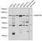 DNA Methyltransferase 3 Beta antibody, 22-805, ProSci, Western Blot image 