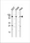 Heat Shock Transcription Factor 2 antibody, TA324656, Origene, Western Blot image 