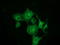 Myotubularin Related Protein 14 antibody, TA501607, Origene, Immunofluorescence image 
