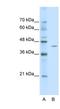 Zinc Finger And BTB Domain Containing 26 antibody, NBP1-80120, Novus Biologicals, Western Blot image 
