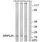 Mitochondrial Ribosomal Protein L20 antibody, PA5-49941, Invitrogen Antibodies, Western Blot image 