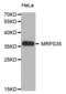 Mitochondrial Ribosomal Protein S35 antibody, abx003730, Abbexa, Western Blot image 