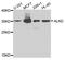 Aminolevulinate Dehydratase antibody, A8398, ABclonal Technology, Western Blot image 