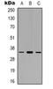 Eukaryotic translation initiation factor 3 subunit J antibody, abx133581, Abbexa, Western Blot image 