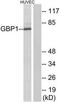 Guanylate Binding Protein 1 antibody, TA311946, Origene, Western Blot image 