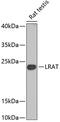 Lecithin retinol acyltransferase antibody, 22-377, ProSci, Western Blot image 