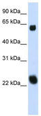 Kelch Like Family Member 26 antibody, TA337229, Origene, Western Blot image 