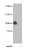 PiggyBac transposable element-derived protein 5 antibody, MBS857140, MyBioSource, Western Blot image 