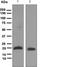 Ubiquitin Conjugating Enzyme E2 M antibody, ab109507, Abcam, Western Blot image 