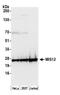 MIS12 Kinetochore Complex Component antibody, NB100-2359, Novus Biologicals, Western Blot image 