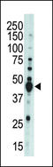 Aurora Kinase B antibody, LS-C100776, Lifespan Biosciences, Western Blot image 
