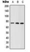 Ald antibody, LS-C353882, Lifespan Biosciences, Western Blot image 
