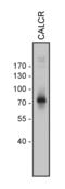 Calcitonin Receptor antibody, 711652, Invitrogen Antibodies, Western Blot image 