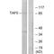 TATA-Box Binding Protein Associated Factor 5 antibody, A08618, Boster Biological Technology, Western Blot image 