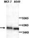 Arfaptin-2 antibody, TA310104, Origene, Western Blot image 
