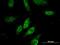 Zinc Finger HIT-Type Containing 3 antibody, H00009326-M09, Novus Biologicals, Immunofluorescence image 