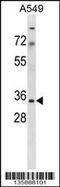 Mitochondrial Ribosomal Protein S15 antibody, 58-526, ProSci, Western Blot image 